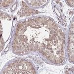 Cofilin 2 Antibody in Immunohistochemistry (Paraffin) (IHC (P))