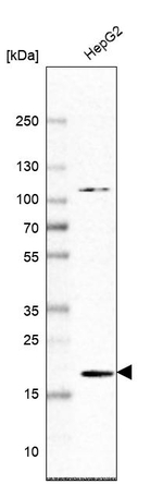 Cofilin 2 Antibody in Western Blot (WB)
