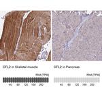 Cofilin 2 Antibody