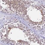 DEFB107A Antibody in Immunohistochemistry (Paraffin) (IHC (P))