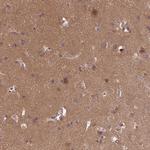 NPEPPS Antibody in Immunohistochemistry (Paraffin) (IHC (P))