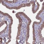 NPEPPS Polyclonal Antibody