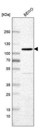 NPEPPS Antibody in Western Blot (WB)