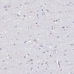 PGRP-S Polyclonal Antibody