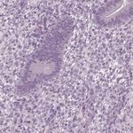 TSKS Polyclonal Antibody