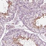 TSKS Antibody in Immunohistochemistry (Paraffin) (IHC (P))