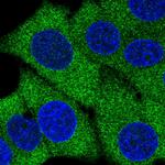 AMPD2 Polyclonal Antibody