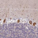 AMPD2 Antibody in Immunohistochemistry (Paraffin) (IHC (P))