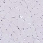 AMPD2 Antibody in Immunohistochemistry (Paraffin) (IHC (P))