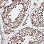 SMYD3 Antibody in Immunohistochemistry (Paraffin) (IHC (P))