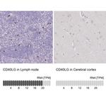CD154 (CD40 Ligand) Antibody