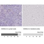 CD154 (CD40 Ligand) Antibody