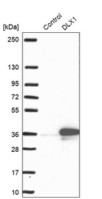 DLX1 Antibody in Western Blot (WB)