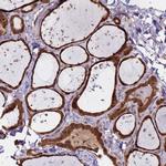ASNA1 Antibody in Immunohistochemistry (Paraffin) (IHC (P))