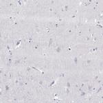 PMCH Antibody in Immunohistochemistry (Paraffin) (IHC (P))