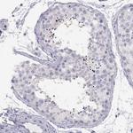 PMCH Antibody in Immunohistochemistry (Paraffin) (IHC (P))