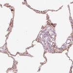 DAPP1 Polyclonal Antibody