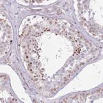 ELL Antibody in Immunohistochemistry (Paraffin) (IHC (P))