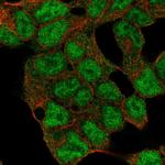 JARID1C Polyclonal Antibody