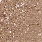SNAP alpha Polyclonal Antibody