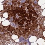 RSPO1 Polyclonal Antibody