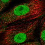 PTPN2 Polyclonal Antibody