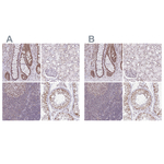 PTPN2 Antibody in Immunohistochemistry (Paraffin) (IHC (P))
