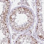 PTPN2 Antibody in Immunohistochemistry (Paraffin) (IHC (P))