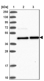 PTPN2 Antibody in Western Blot (WB)