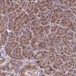 HPS3 Polyclonal Antibody