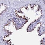 PRY Polyclonal Antibody