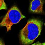 RPL17 Polyclonal Antibody