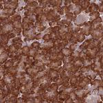RPL17 Antibody in Immunohistochemistry (Paraffin) (IHC (P))
