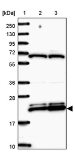 RPL17 Antibody in Western Blot (WB)