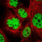 Pokemon Antibody in Immunocytochemistry (ICC/IF)