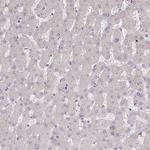 Pokemon Antibody in Immunohistochemistry (Paraffin) (IHC (P))