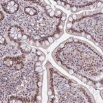 Pokemon Antibody in Immunohistochemistry (Paraffin) (IHC (P))