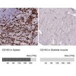 CD163 Antibody