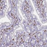 CD163 Antibody in Immunohistochemistry (Paraffin) (IHC (P))