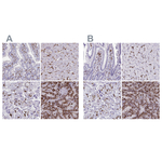 CD163 Antibody in Immunohistochemistry (Paraffin) (IHC (P))