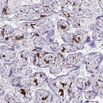 CD163 Antibody in Immunohistochemistry (Paraffin) (IHC (P))