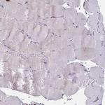 CD163 Antibody in Immunohistochemistry (Paraffin) (IHC (P))