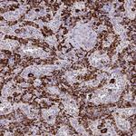 CD163 Antibody in Immunohistochemistry (Paraffin) (IHC (P))