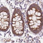 HIP Antibody in Immunohistochemistry (Paraffin) (IHC (P))