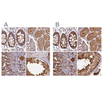 HIP Antibody in Immunohistochemistry (Paraffin) (IHC (P))