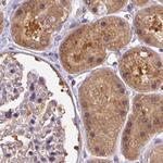 HIP Antibody in Immunohistochemistry (Paraffin) (IHC (P))