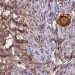 HIP Antibody in Immunohistochemistry (Paraffin) (IHC (P))