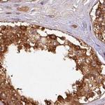 HIP Antibody in Immunohistochemistry (Paraffin) (IHC (P))