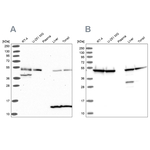 HIP Antibody in Western Blot (WB)