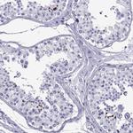 SPANXC Antibody in Immunohistochemistry (Paraffin) (IHC (P))